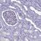 Solute Carrier Family 1 Member 6 antibody, PA5-59600, Invitrogen Antibodies, Immunohistochemistry paraffin image 