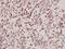 Armadillo Repeat Containing X-Linked 2 antibody, A16296-1, Boster Biological Technology, Immunohistochemistry frozen image 