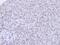 PEST Proteolytic Signal Containing Nuclear Protein antibody, PA5-22203, Invitrogen Antibodies, Immunohistochemistry paraffin image 