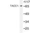 Transforming Acidic Coiled-Coil Containing Protein 1 antibody, LS-C177116, Lifespan Biosciences, Western Blot image 