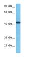 Zinc Finger Protein 410 antibody, orb324799, Biorbyt, Western Blot image 