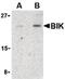 BCL2 Interacting Killer antibody, PA5-20249, Invitrogen Antibodies, Western Blot image 