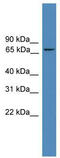 Zinc Finger Protein 304 antibody, TA345292, Origene, Western Blot image 