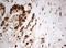 TIMELESS Interacting Protein antibody, M08219, Boster Biological Technology, Immunohistochemistry paraffin image 