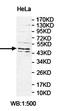 O-Sialoglycoprotein Endopeptidase Like 1 antibody, orb78267, Biorbyt, Western Blot image 