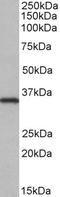 NIMA Related Kinase 7 antibody, EB10519, Everest Biotech, Western Blot image 