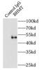 Betaine--Homocysteine S-Methyltransferase antibody, FNab00890, FineTest, Immunoprecipitation image 