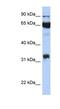 Prostaglandin-Endoperoxide Synthase 1 antibody, NBP1-62466, Novus Biologicals, Western Blot image 