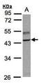 TNF Receptor Associated Factor 1 antibody, GTX102372, GeneTex, Western Blot image 