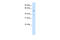 Thyroid Hormone Receptor Beta antibody, 28-599, ProSci, Enzyme Linked Immunosorbent Assay image 