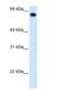 Aldehyde Dehydrogenase 4 Family Member A1 antibody, NBP1-54740, Novus Biologicals, Western Blot image 