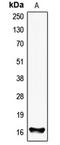 Fragile Histidine Triad Diadenosine Triphosphatase antibody, LS-C352195, Lifespan Biosciences, Western Blot image 