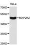 Mitogen-Activated Protein Kinase Kinase 2 antibody, abx126967, Abbexa, Western Blot image 