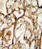 Solute Carrier Family 3 Member 2 antibody, LS-C161247, Lifespan Biosciences, Immunohistochemistry paraffin image 