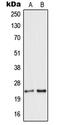 Secretogranin V antibody, LS-C352836, Lifespan Biosciences, Western Blot image 