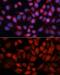 Acyl-CoA Dehydrogenase Medium Chain antibody, GTX32421, GeneTex, Immunofluorescence image 