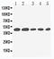 Interleukin 2 Receptor Subunit Gamma antibody, LS-C312769, Lifespan Biosciences, Western Blot image 