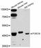 Probable protein-cysteine N-palmitoyltransferase porcupine antibody, abx126396, Abbexa, Western Blot image 