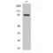 Cortactin antibody, LS-C381441, Lifespan Biosciences, Western Blot image 