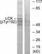 LCK Proto-Oncogene, Src Family Tyrosine Kinase antibody, A00425Y192, Boster Biological Technology, Western Blot image 