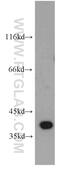 ELOVL Fatty Acid Elongase 4 antibody, 55023-1-AP, Proteintech Group, Western Blot image 