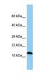 Sperm Autoantigenic Protein 17 antibody, orb325885, Biorbyt, Western Blot image 