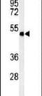 Sphingomyelin Phosphodiesterase Acid Like 3A antibody, PA5-24899, Invitrogen Antibodies, Western Blot image 