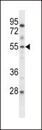 ETS Variant 6 antibody, LS-C167847, Lifespan Biosciences, Western Blot image 