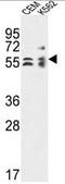 Tubulin Folding Cofactor E antibody, AP54178PU-N, Origene, Western Blot image 