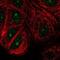 Nudix Hydrolase 16 antibody, NBP2-37976, Novus Biologicals, Immunofluorescence image 