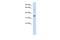 Retroviral-like aspartic protease 1 antibody, A12275, Boster Biological Technology, Western Blot image 