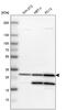 Carbonic Anhydrase 2 antibody, PA5-51598, Invitrogen Antibodies, Western Blot image 