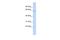 Methyl-CpG Binding Domain 4, DNA Glycosylase antibody, PA5-68656, Invitrogen Antibodies, Western Blot image 