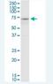 Collagen alpha-2(VIII) chain antibody, H00001296-M01-100ug, Novus Biologicals, Western Blot image 