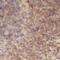 Transmembrane And Coiled-Coil Domains 6 antibody, FNab08737, FineTest, Immunohistochemistry paraffin image 