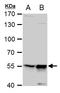 DNA Nucleotidylexotransferase antibody, GTX108697, GeneTex, Western Blot image 