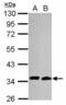 Cell Division Cycle 34 antibody, NB500-168, Novus Biologicals, Western Blot image 
