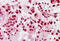 Heterogeneous Nuclear Ribonucleoprotein K antibody, MBS244305, MyBioSource, Immunohistochemistry frozen image 