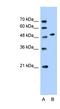 Solute Carrier Family 30 Member 1 antibody, NBP1-62525, Novus Biologicals, Western Blot image 