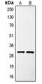 SURF1 Cytochrome C Oxidase Assembly Factor antibody, orb214632, Biorbyt, Western Blot image 