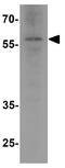 Cytochrome B-245 Beta Chain antibody, GTX31930, GeneTex, Western Blot image 