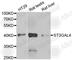 ST3 Beta-Galactoside Alpha-2,3-Sialyltransferase 4 antibody, A6309, ABclonal Technology, Western Blot image 