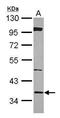 High Mobility Group 20B antibody, GTX115399, GeneTex, Western Blot image 