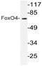 Forkhead Box O4 antibody, AP20684PU-N, Origene, Western Blot image 
