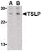 Thymic Stromal Lymphopoietin antibody, PA5-20319, Invitrogen Antibodies, Western Blot image 