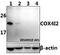 Cytochrome C Oxidase Subunit 4I2 antibody, A10078, Boster Biological Technology, Western Blot image 