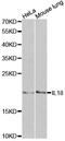 Interleukin 18 antibody, MBS126797, MyBioSource, Western Blot image 