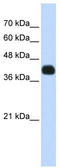 ISL LIM Homeobox 2 antibody, TA345530, Origene, Western Blot image 