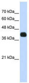 Insulin gene enhancer protein ISL-2 antibody, TA345530, Origene, Western Blot image 