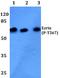 Ezrin antibody, A01750T567T564T558, Boster Biological Technology, Western Blot image 